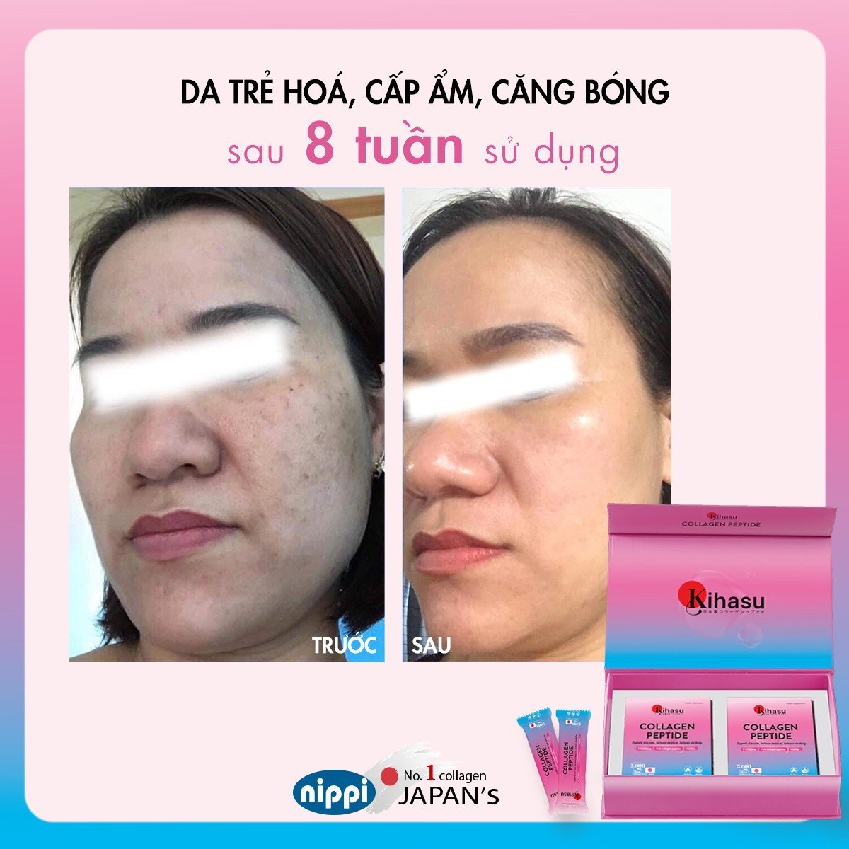 Công dụng của Kihasu Collagen Peptide