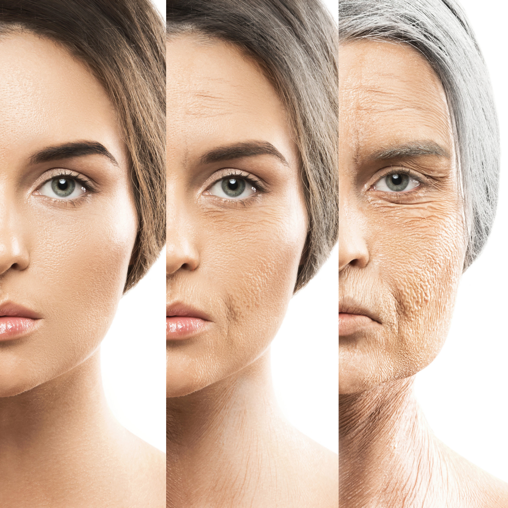 6 dấu hiệu cho biết cơ thể đang thiếu "Collagen" nghiêm trọng