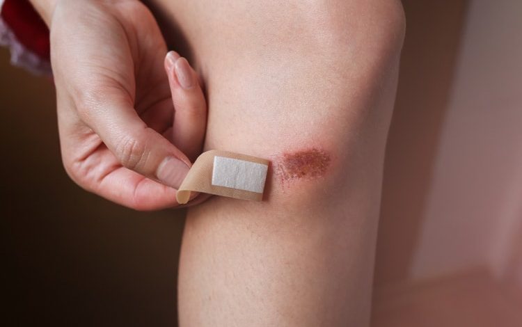 6 dấu hiệu cho biết cơ thể đang thiếu "Collagen" nghiêm trọng